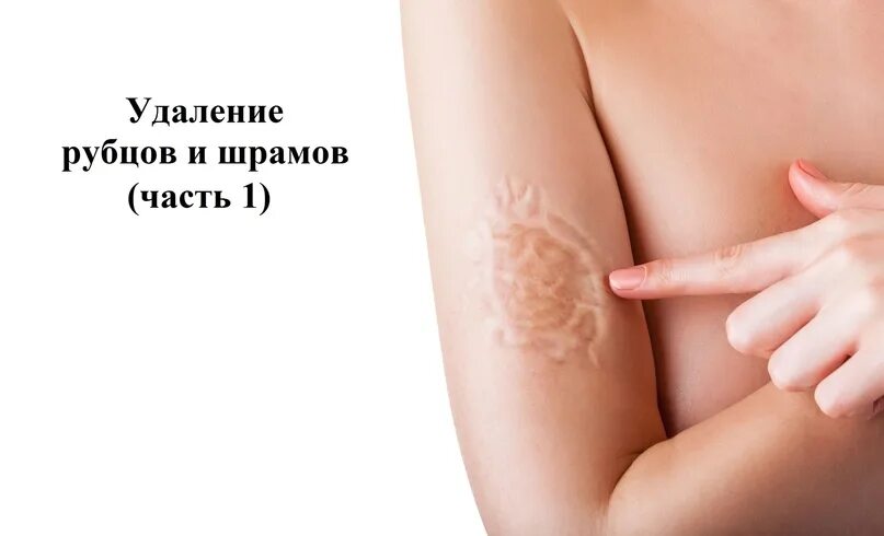 #Grozny #нужно_spa #ищу_spa shikari.do А сколько стоит #пилинг? Ссылка: https://