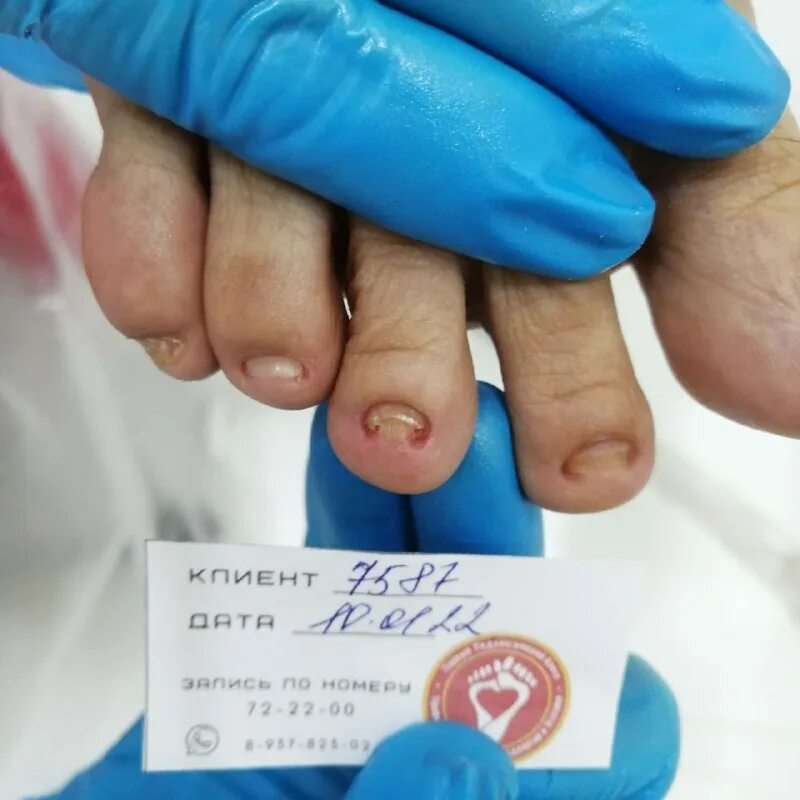 первый подологический центр архангельск