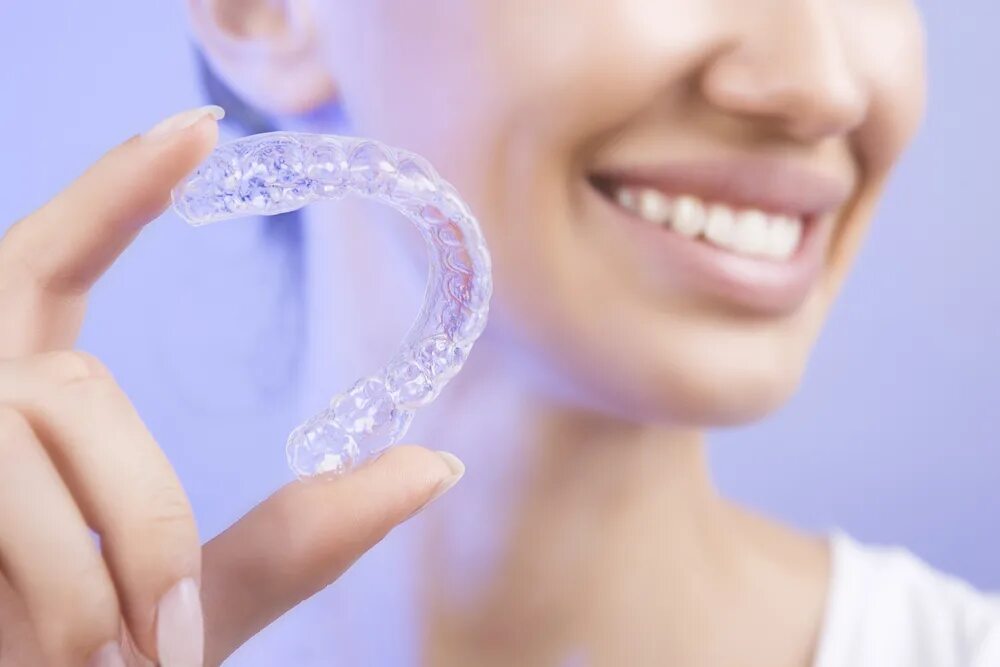 Invisalign. Элайнеры инвизилайн. элайнеры invisalign. элайнеры star smile. элайнеров invisalign.