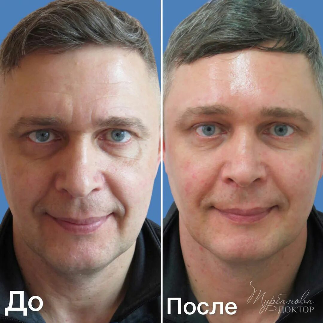 Что такое бьютификация волос фото Strazi-Nail.ru