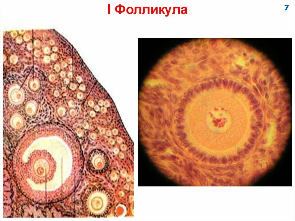 Как выглядит фолликул. Фолликулы. яйцеклетка в фолликуле. яйцеклетка в разрезе.