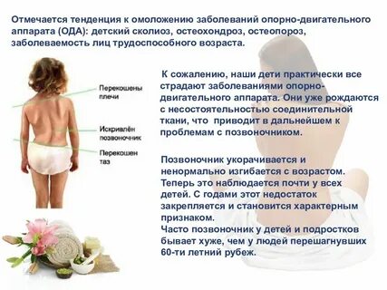 Профилактика опорно двигательных заболеваний