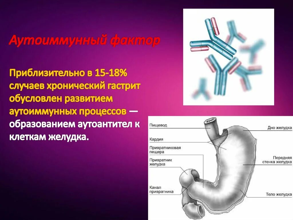 Аутоиммунный гастрит этиология. Хронический аутоиммунный гастрит. Хронический аутоиммунный гастрит патогенез. Аутоиммунный гастрит патогенез. Аутоиммунный гастрит клинические