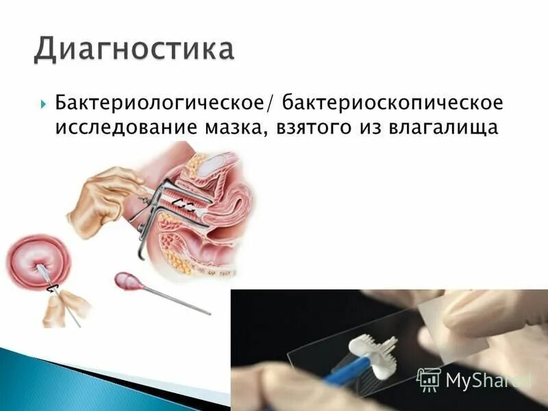 бактериоскопическое исследование в гинекологии