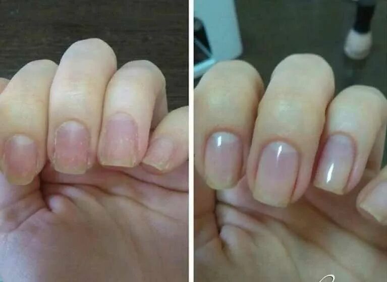 Маникюр до и после. Ламинирование ногтей. Маникюр с укреплением.
