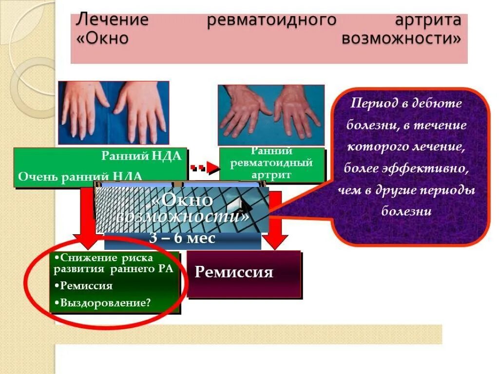 Ранняя стадия ревматоидного артрита. Симптоматическая терапия ревматоидного артрита. Лечениетревматоидного артрита. Лечение реаматоидноготартрита. Терапия ревматоидного артрита алгоритм.