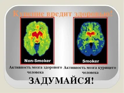 Влияние курения на мозг
