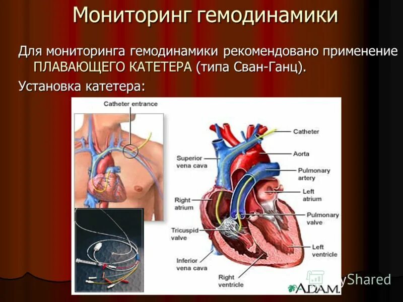 Нестабильная гемодинамика