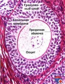 Гранулеза