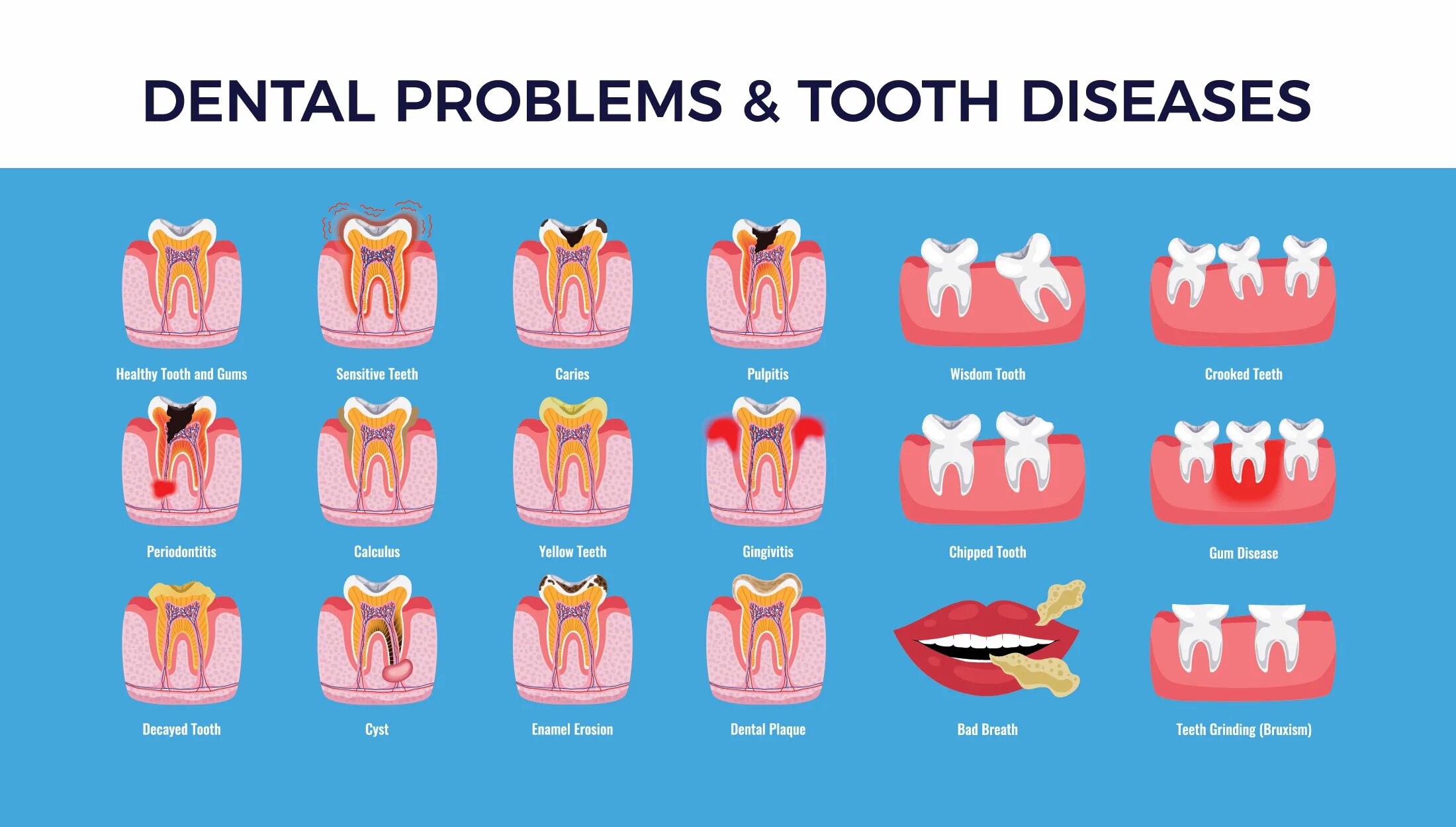 Tooth problems