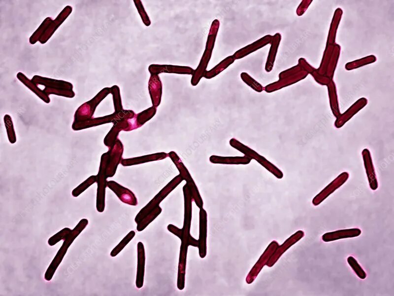 Клостридии орви бактериальное или вирусное. Clostridium botulinum микроскоп. бацилла и клостридия. бациллы и клостридии.