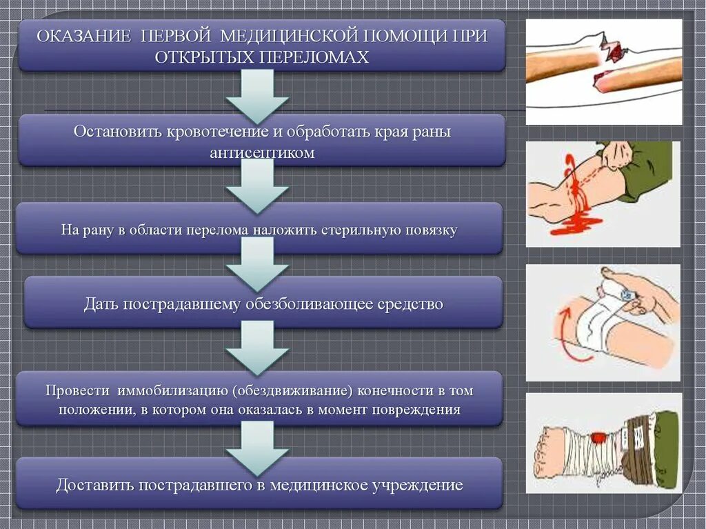 Алгоритм оказания ПМП при переломе открытом. Алгоритм оказания первой помощи при переломе конечностей. Алгоритм оказания первой помощи пострадавшему открытый перелом. Алгоритм оказания доврачебной помощи при переломе. Тест обж манипуляции