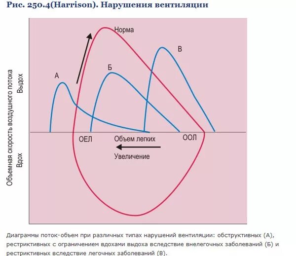 Смешанный Тип нарушения вентиляции легких спирометрия. Смешанный Тип вентиляционных нарушений. Типы нарушения вентиляции. Рестриктивный и обструктивный типы нарушения вентиляции.