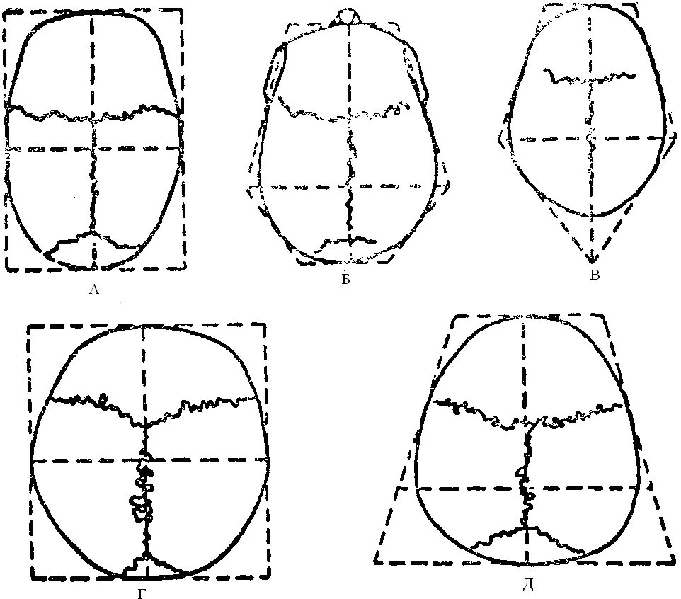 Варианты формы черепа. Эллипсоидная форма черепа. Формы черепа классификация.