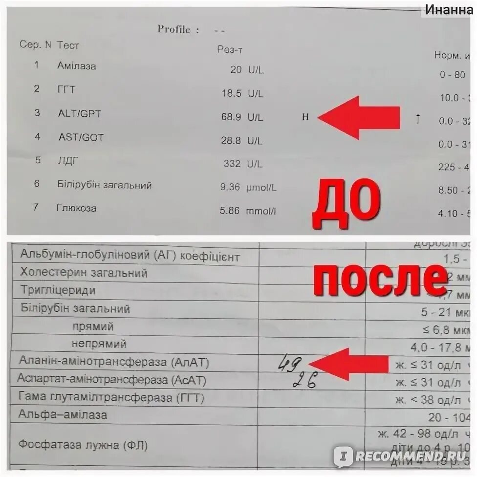 Гептрал и алт. Гептрал АСТ алт. Может ли гептрал повысить алт и АСТ. После 5 уколов гептрала улучшились показатели алт и АСТ. Гептрал как влияет на Аль и АСТ.