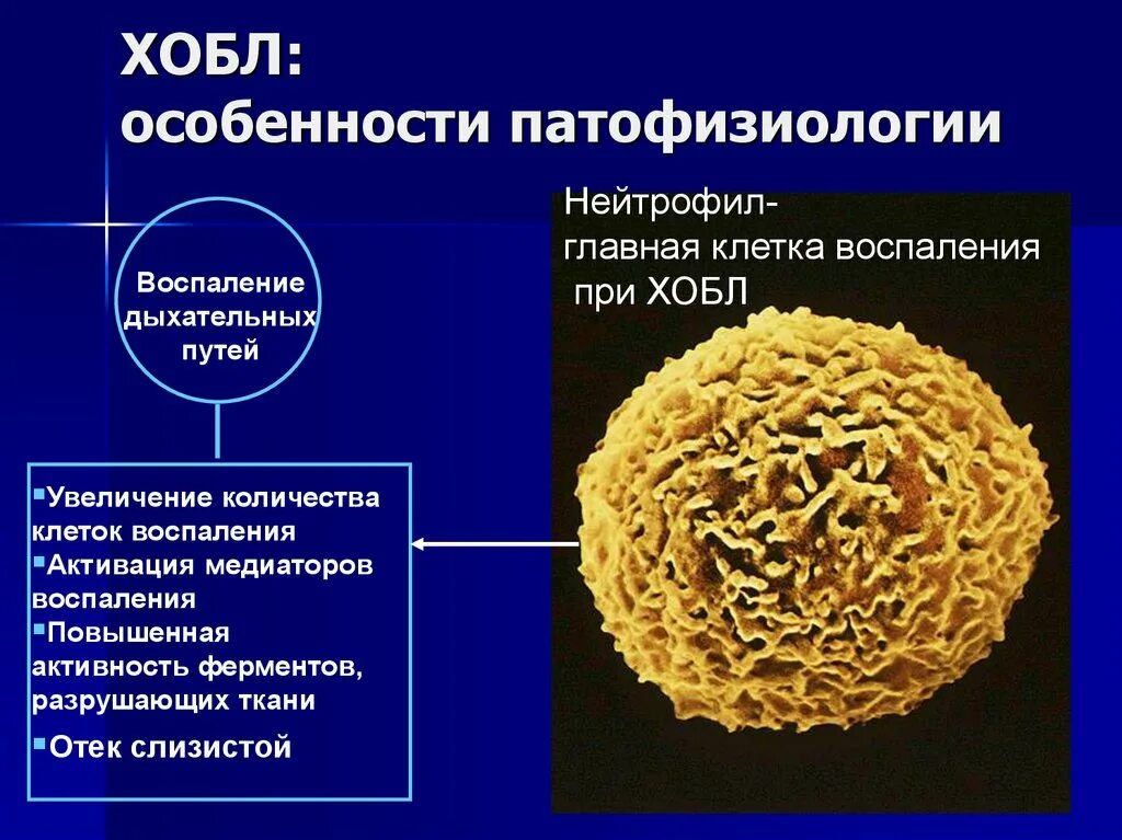 Особенности ХОБЛ. ХОБЛ медиаторы воспаления. ХОБЛ патофизиология. Хронический бронхит патофизиология. Хронический бронхит хобл