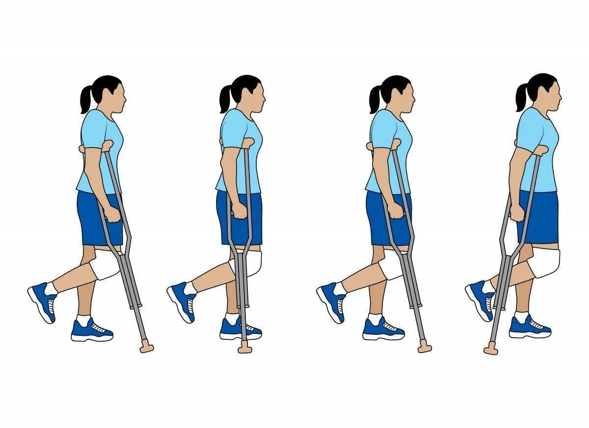 Как подниматься по лестнице после эндопротезирования. Ходьба на локтевых костылях. Как ходить на костылях. Техника хождения на костылях. Правильная ходьба на костылях.