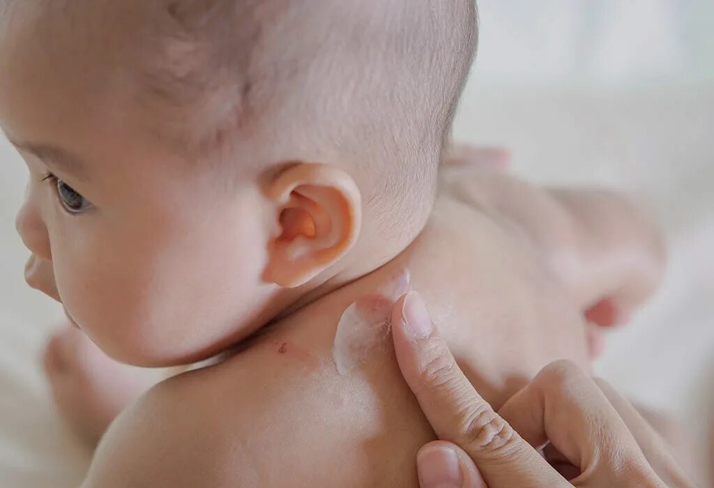 Уходовая косметика для новорожденных. Лишай у новорожденных детей. Skinny baby. Косметика для малышей с рождения. Чистый ребенок.