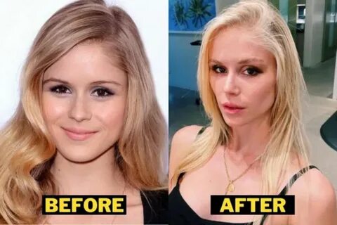 Erin moriarity plastic surgery