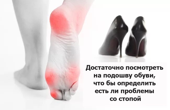 Стирается подошва на пятке с внешней. Стирается подошва на пятке с внешней