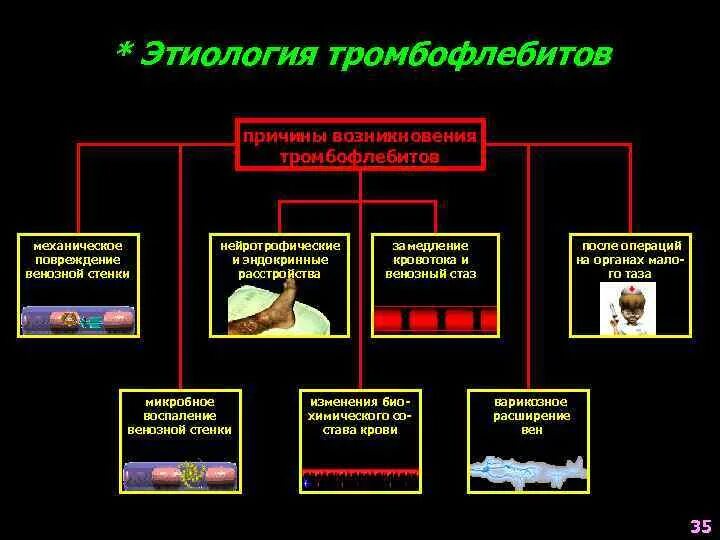 Тромбоз возникновение. Этиология тромбоза. Этиология тромба. Механизм развития тромбообразования. Этиология флеботромбоза.