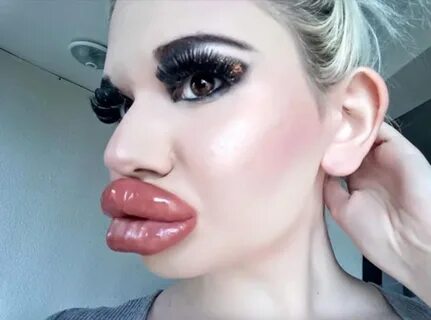 Andrea Ivanova, la donna con le "labbra più grandi del mondo" .