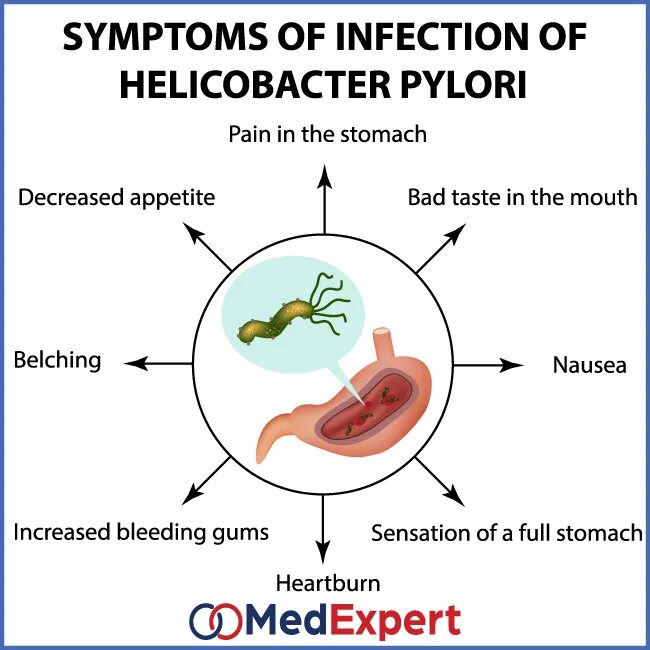Хеликобактер пилори лофотрих. Инфекция h. Helicobacter pylori infection. Язвенная болезнь хеликобактер пилори. Язва желудка бактерия хеликобактер.