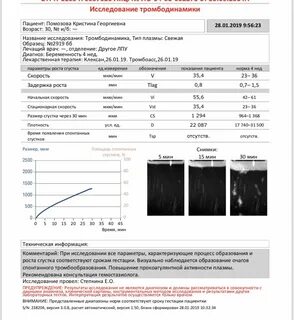 Тромбодинамика