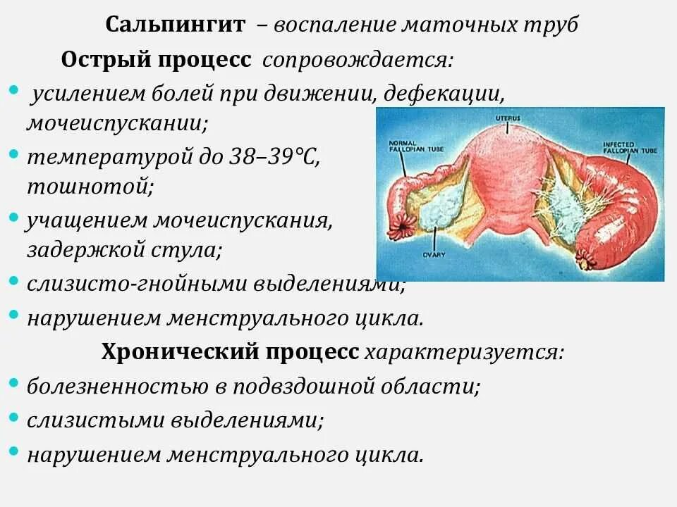 Гонорейный сальпингоофорит. Хронический неспецифический сальпингит. Гонорейный сальпингит. Почему появляются воспаления