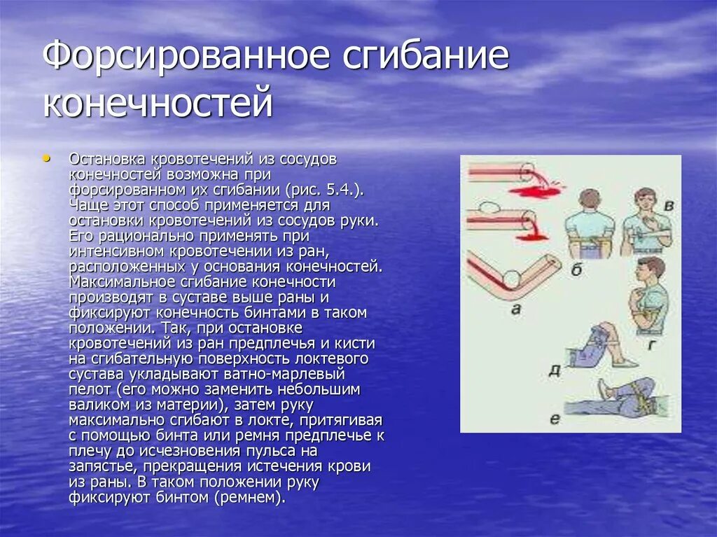Методы остановки кровотечения из сосудов конечностей путем их. Кровотечение способы остановки кровотечения. Максимальное гибаниеконечности в сутсве. Форсированное сгибание. Форсированное сгибание.