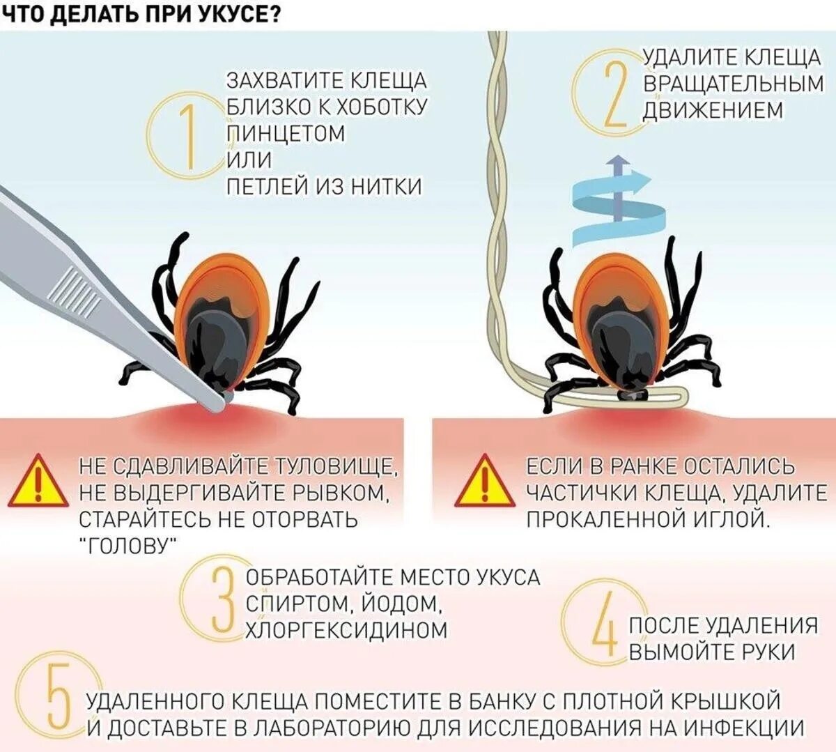 Какую кровь любят клещи. Клещи. Места присасывания клеща схема.