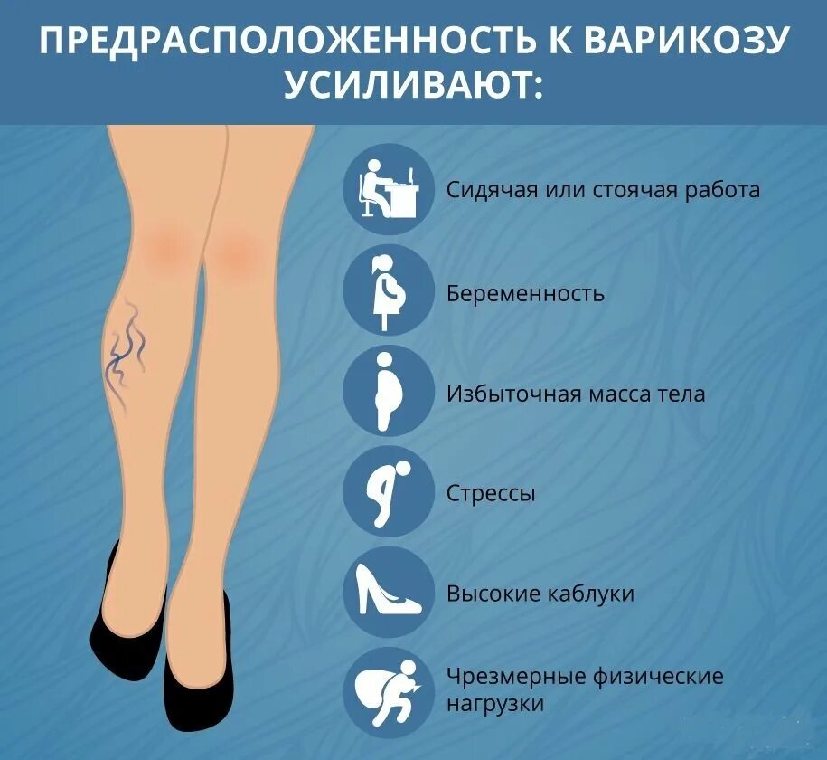 Причины расширения вен на ногах