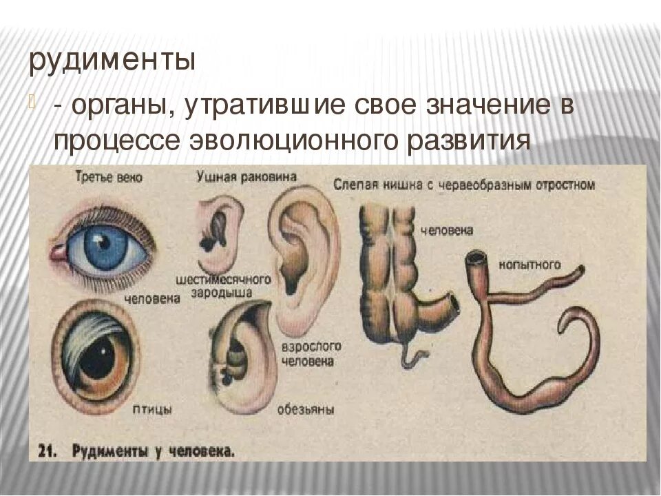 Каким образом рудименты и атавизмы доказывают. Атавизмы и рудименты человека. Рудиментарные органы в биологии 7 класс. , Рудименты (с примерами), атавизмы (с примерами)..