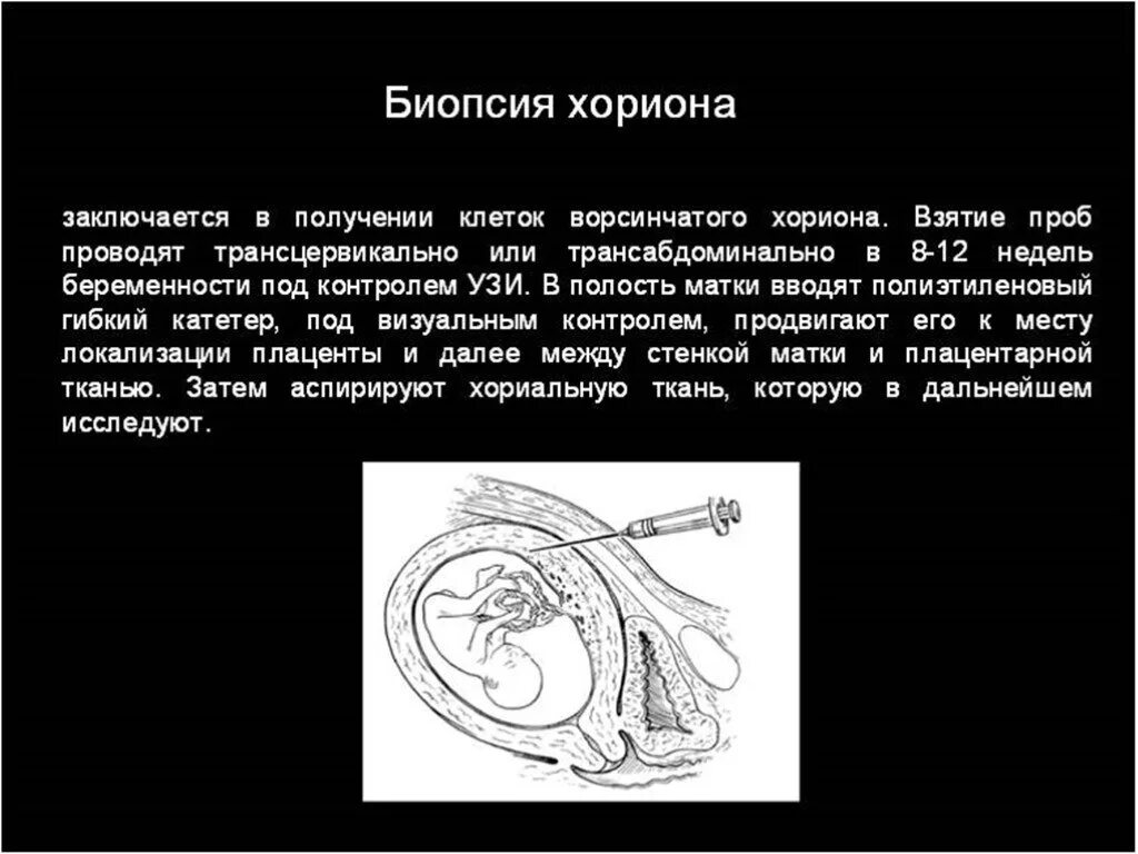 Биопсия хориона это. Биопсия ворсин хориона сроки проведения. трансцервикальная биопсия ворсин хориона. биопсия хориона показания.