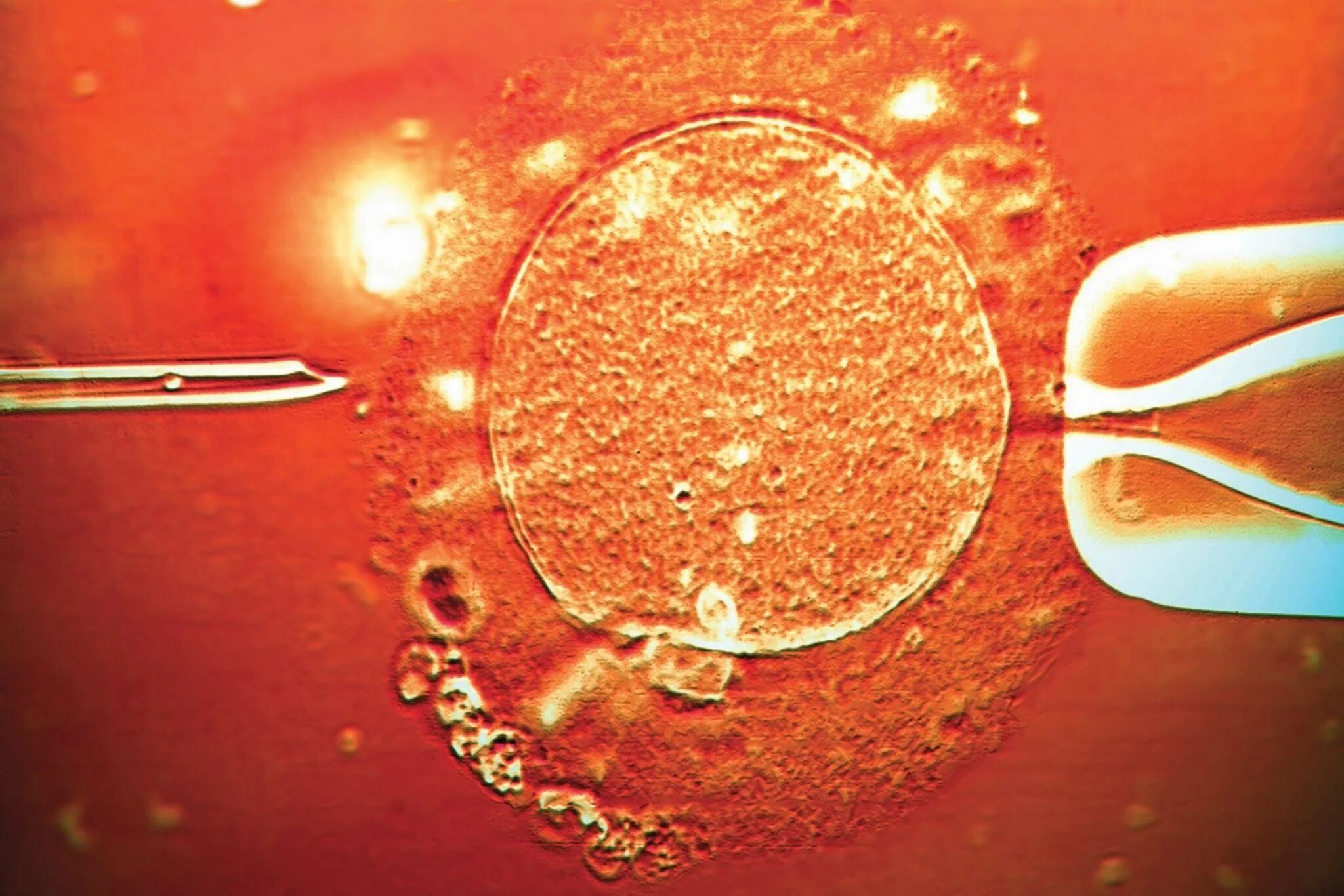 Экстракорпоральное оплодотворение ооцитов. Оплодотворение яйцеклетки эко. Яйцеклетка в пробирке. Эко это искусственное оплодотворение.