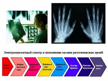 Гамма рентгеновское