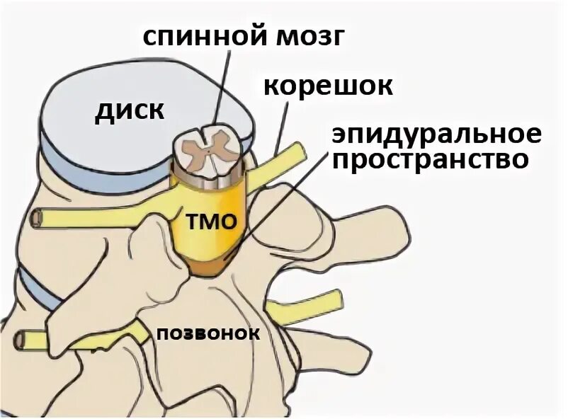 Компрессия дурального мешка что это. Дуральный мешок позвоночника. отделы дурального мешка. переднее эпидуральное пространство позвоночника. эпидуральное пространство спинного мозга.