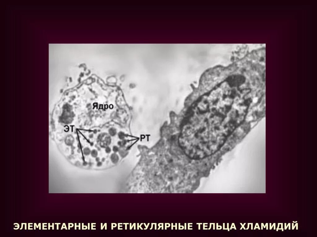 Хламидии формы. Ультраструктура хламидий. Элементарные и ретикулярные тельца хламидий. Элементарные (эт) и ретикулярные (РТ) тельца хламидий. Ретикулярное тельце хламидий.