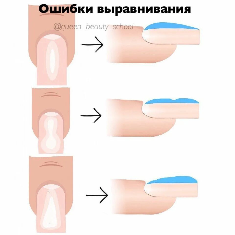 Как правильно выравнивать ногти базой. Схема выравнивания ногтевой пластины базой. схема выравнивания ногтевой пластины гелем. опил ногтевой пластины схемы. техника выравнивания ногтевой пластины схема.