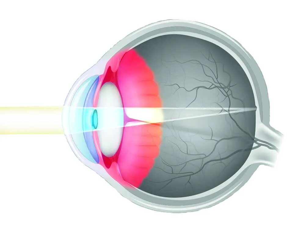 Изображение на сетчатке глаза появляется. Анатомия глаза. Зрение на прозрачном фоне. Физиологическая оптика. Линзы глаз анатомия.
