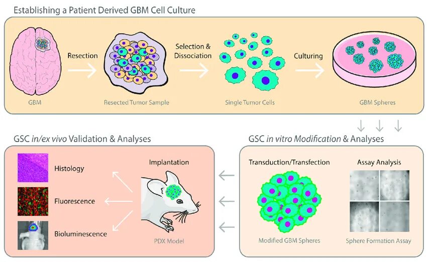 Patient derived. Ксенографт мыши. Дифференцировка нейробластов. Patient derived. Xenograft.
