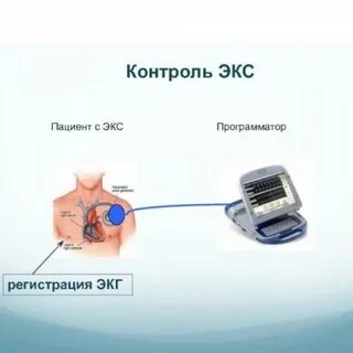 Экс что это
