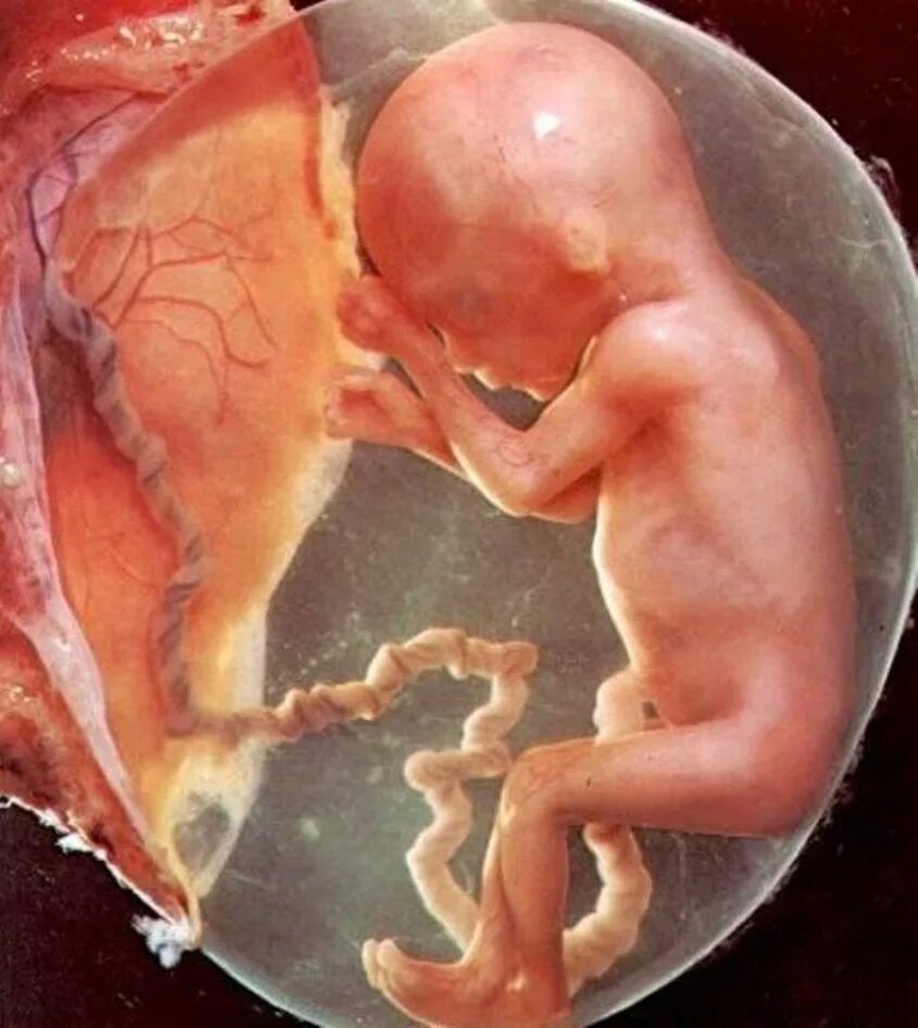 Развитие ребёнка по неделям. Ребенок в животе на 4 месяце. Зародыш на 8 неделе беременности. Ребенок в животе на 4 месяце. Развитие плода в утробе матери.