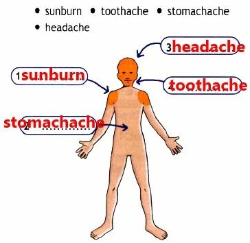 Use the Words in the list to Label the diagram. Use the Words in the list to Label the diagram. Sunburn headache toothache * stomachache to. Complete the Words Sunburn. Use the words to label the