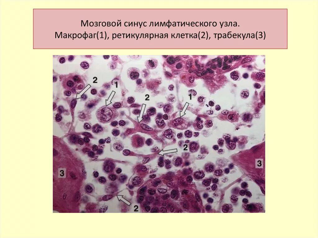 Клетки лимфатического узла гистология. Макрофаги, гистиоциты фагоцитоз гистология. Ретикулярная ткань гистология. Макрофаги ретикулярной ткани. Свободные макрофаги