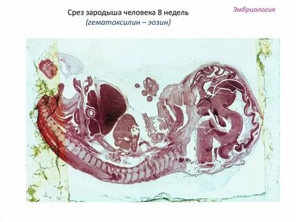 Препарат зародыша