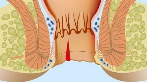 Ойыншықтары бар эротикалық бейнелер