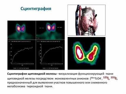 Стенография щитовидной железы