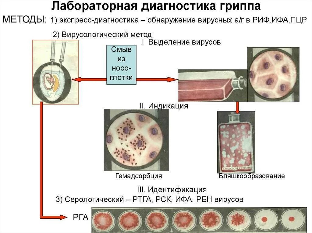 Методы определения гриппа. Методы лабораторной диагностики гриппа и орви.. метод лабораторной диагностики вирусов гриппа. методы лабораторной диагностики гриппа микробиология. методы диагностики вирусов микробиология.