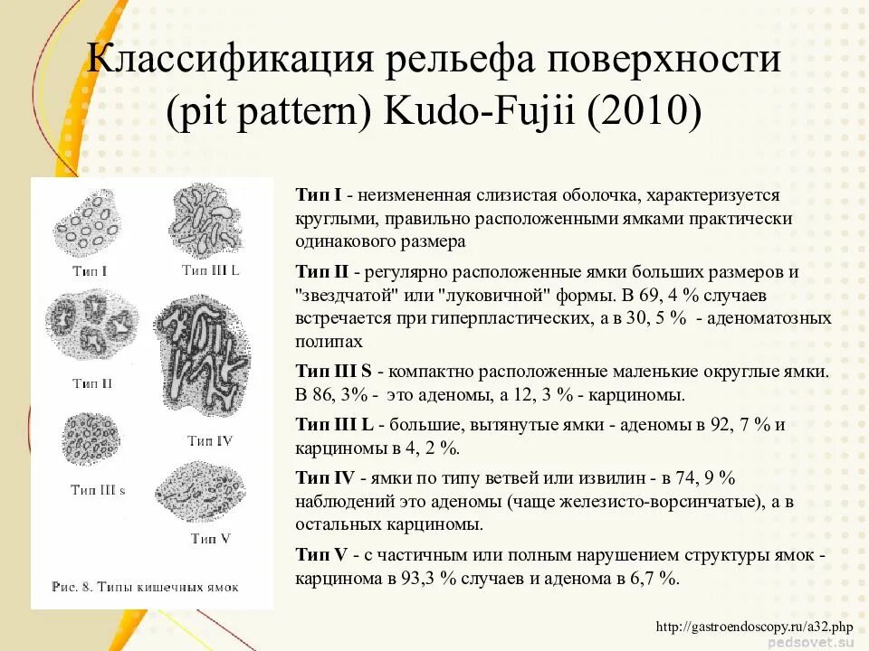 Тип 0 is. Классификация рельефа поверхности Pit pattern Kudo-Fujii 2010. Kudo классификация полипов. Kudo классификация полипов толстой кишки. Классификация КУДО эндоскопия.
